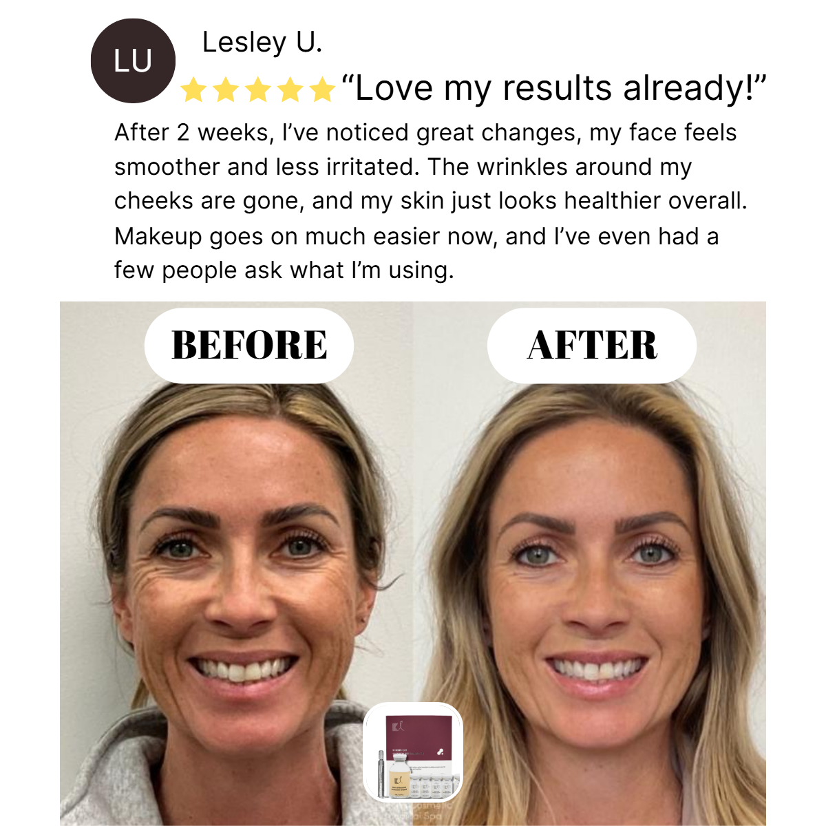 Radiant Glow Microinfusion Serum™
